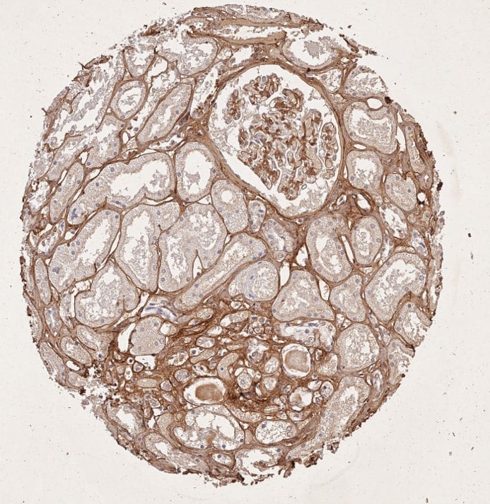 Collagen Type I IHC