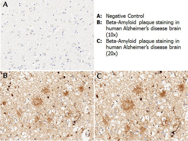 anti-beta amyloid antibody