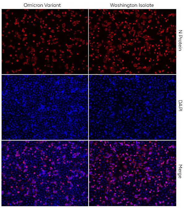 Omicron Immunofluorescence Microscopy