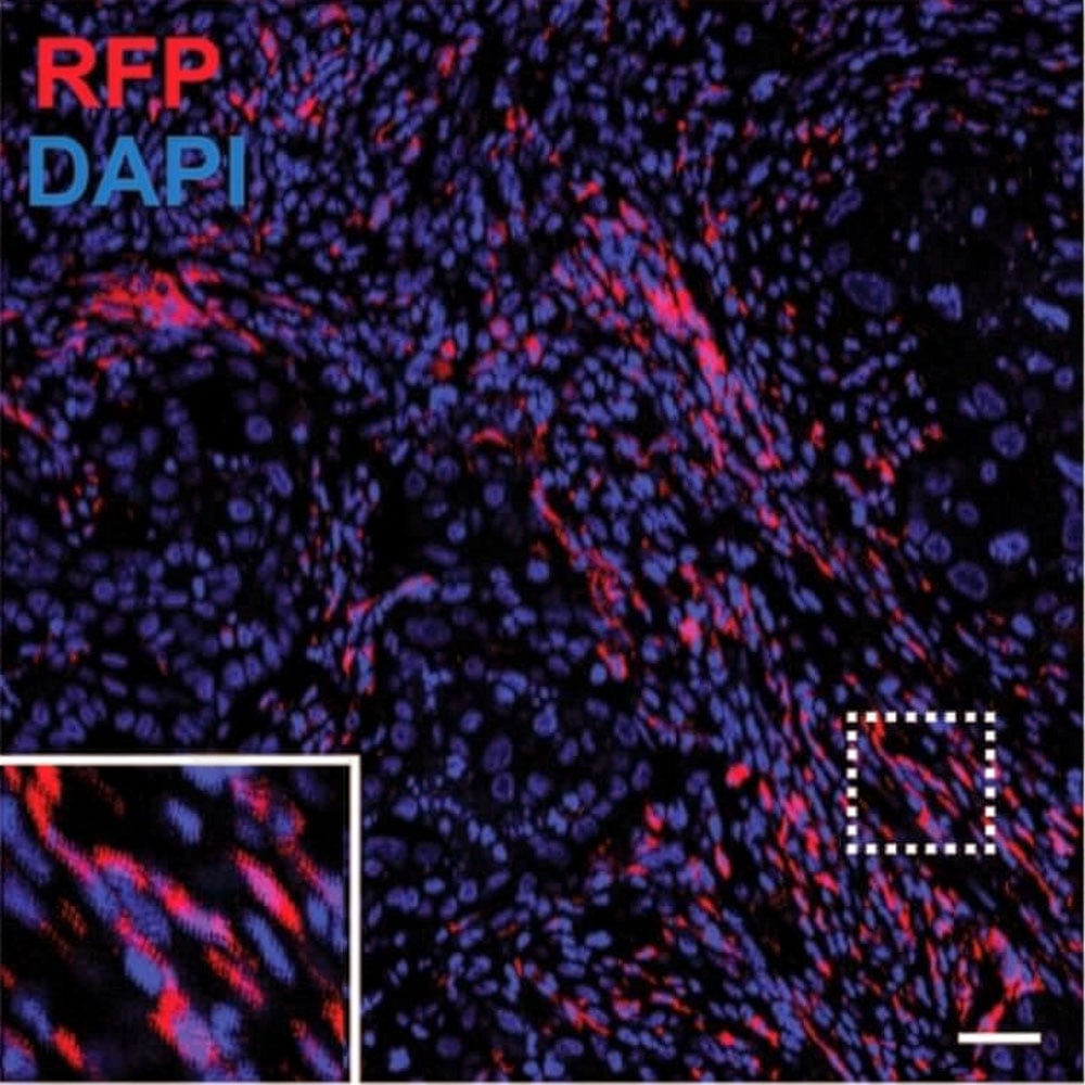 RFP Antibody